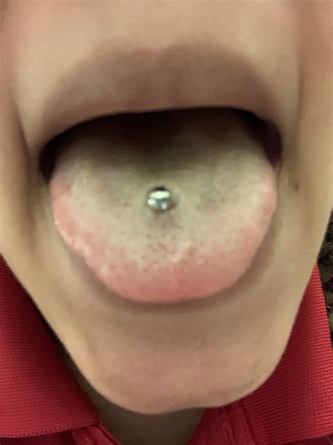 how do you know if your tongue ring is infected